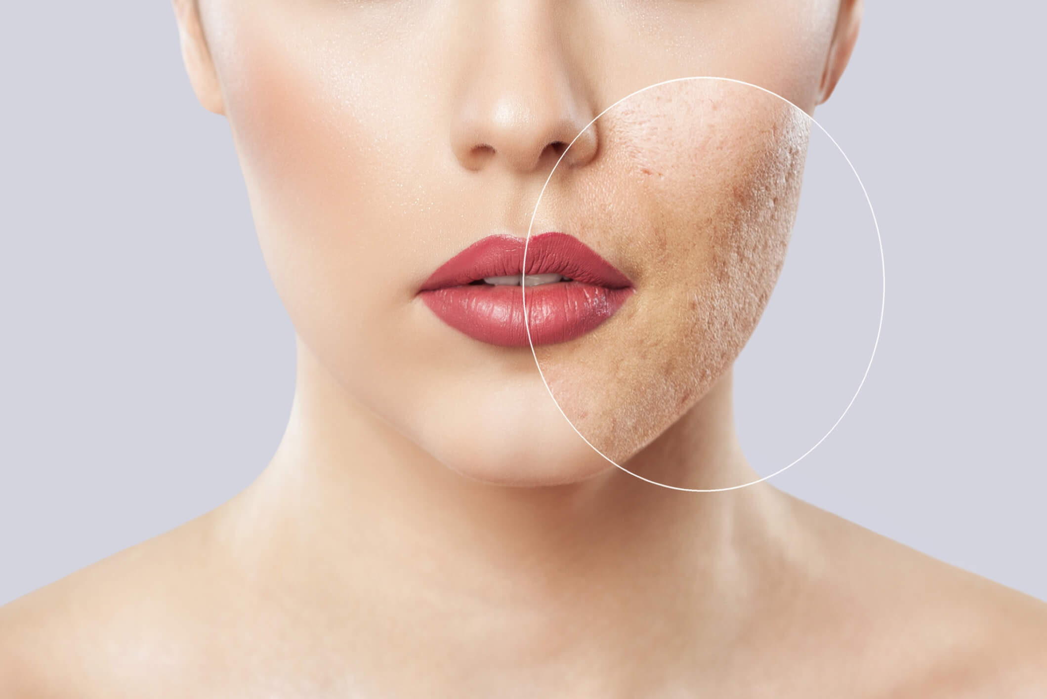 A facial rejuvenation procedure that uses a laser to improve the skin's appearance or treat minor facial flaws.